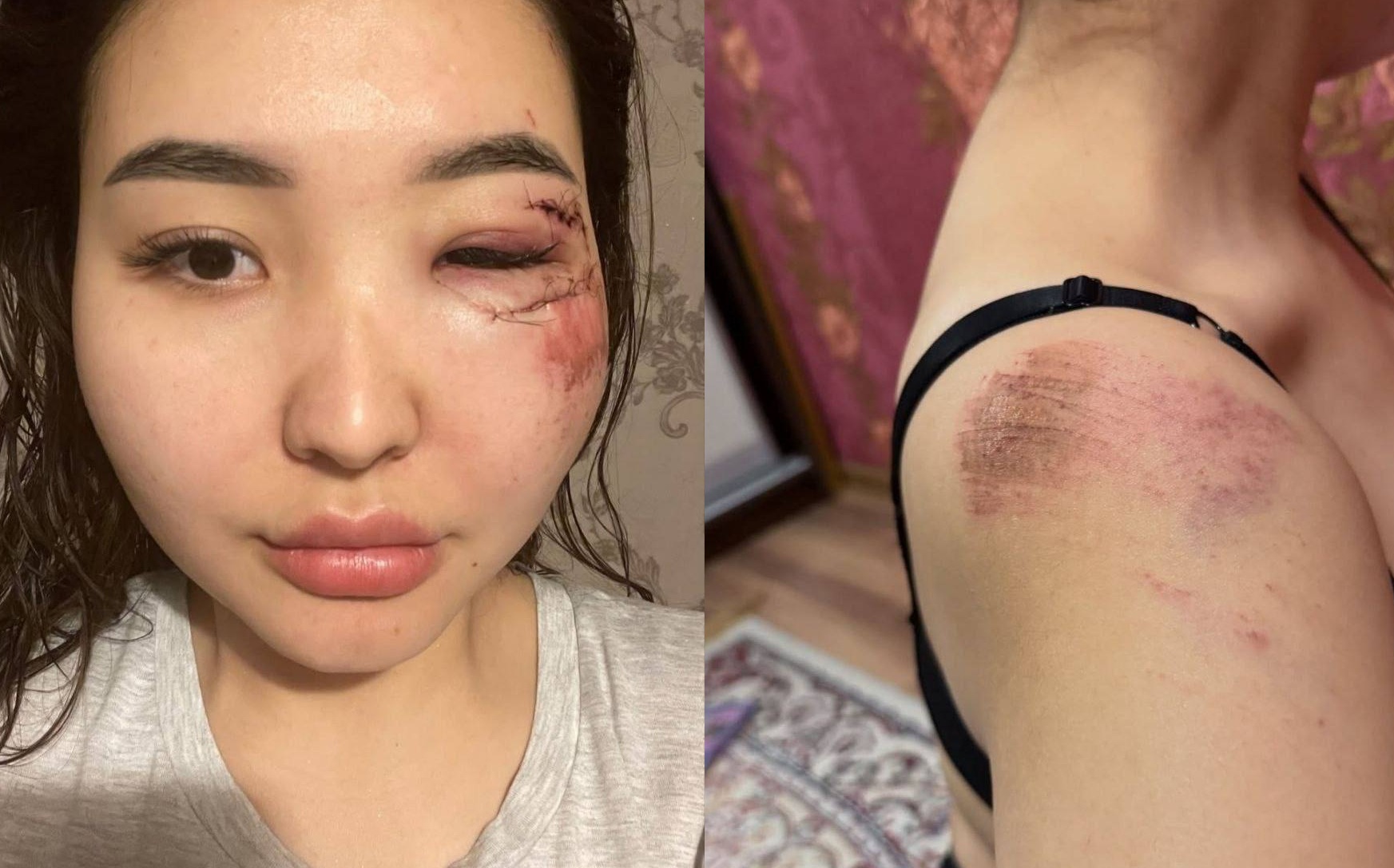 По факту избиение жительницы Атырау возбуждено уголовное дело